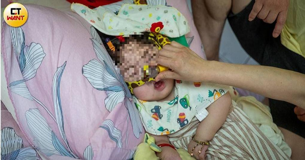 钱钱如今得依靠呼吸器维持生命体征,连喂奶都得从胃部造口中灌入。 钱钱如今得依靠呼吸器维持生命体征,连喂奶都得从胃部造口中灌入。