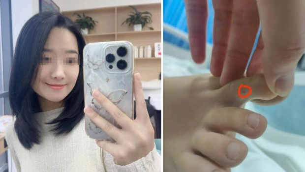 李甜甜日前脚部遭蛇咬,先后向两间医院求诊但在2日不治。 李甜甜日前脚部遭蛇咬,先后向两间医院求诊但在2日不治。