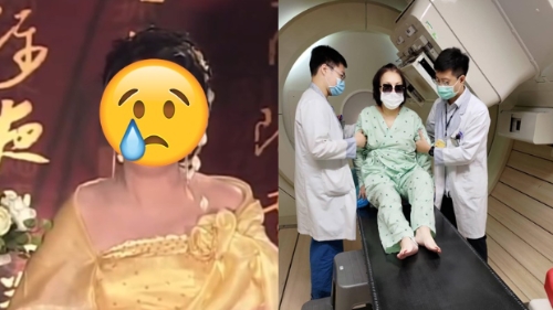 75岁殿堂女星癌症复发 75岁殿堂女星癌症复发