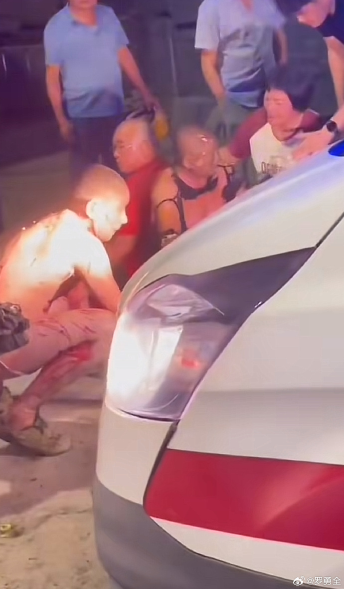 现场有人衣服被烧光等待救治。 现场有人衣服被烧光等待救治。