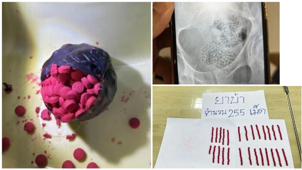 奥地利男在泰国机场抽搐痾“粉红液体”, 奥地利男在泰国机场抽搐痾“粉红液体”,