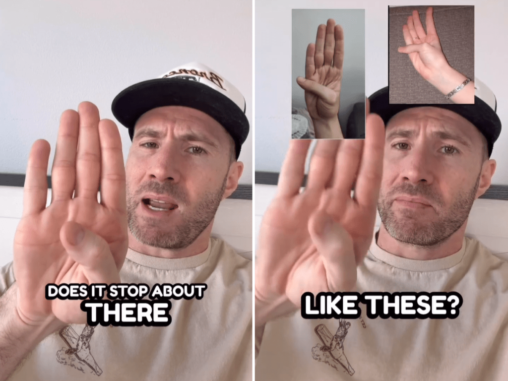 拇指掌心测试,3秒钟自测主动脉瘤风险。 拇指掌心测试,3秒钟自测主动脉瘤风险。