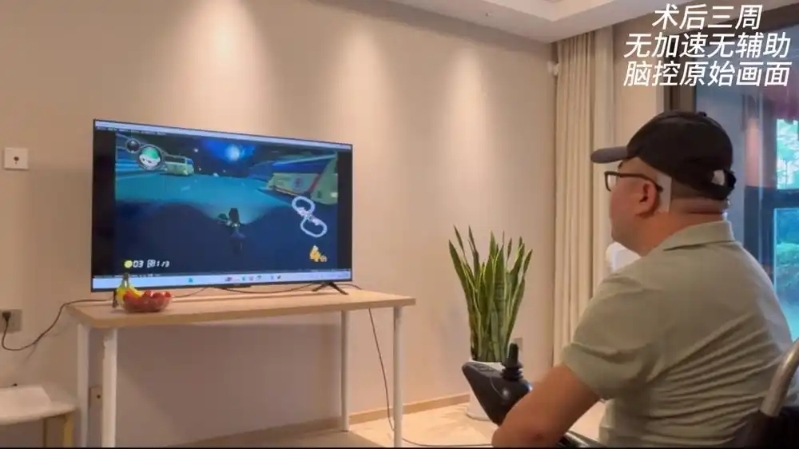 首例侵入式脑机接口临床试验 首例侵入式脑机接口临床试验