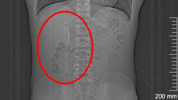 生吞15cm勺子 生吞15cm勺子