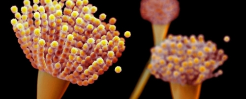 致命真菌入侵美国急速扩散 致命真菌入侵美国急速扩散