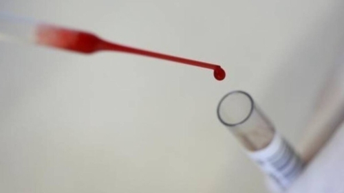 法国宣布找到新血型,令人类血型系统增加至48种。 法国宣布找到新血型,令人类血型系统增加至48种。