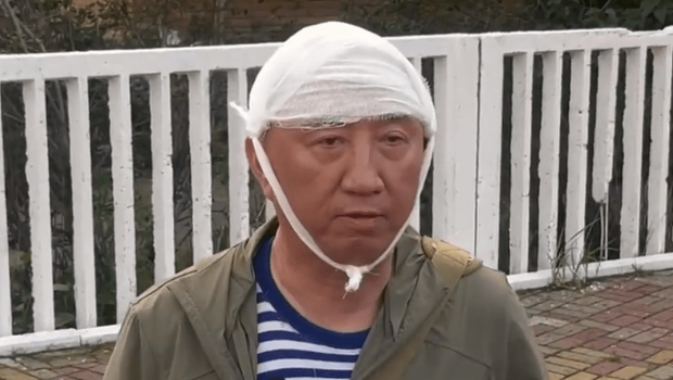 凤凰卫视战地记者卢宇光头部受伤。 凤凰卫视战地记者卢宇光头部受伤。