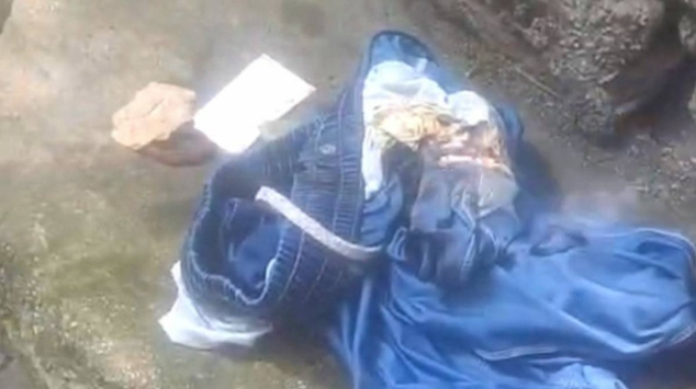 “奇石”在裤袋中突然发生自燃。天眼新闻 “奇石”在裤袋中突然发生自燃。天眼新闻