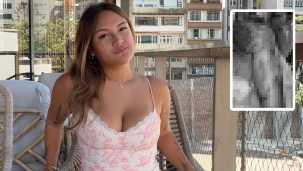 波士顿大学香港交换生因酒精爆炸身体3成烧伤 波士顿大学香港交换生因酒精爆炸身体3成烧伤