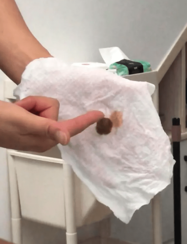 浙江多个小区自来水散发屎臭。 浙江多个小区自来水散发屎臭。