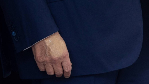 特朗普在手背上涂抹遮瑕膏。 特朗普在手背上涂抹遮瑕膏。