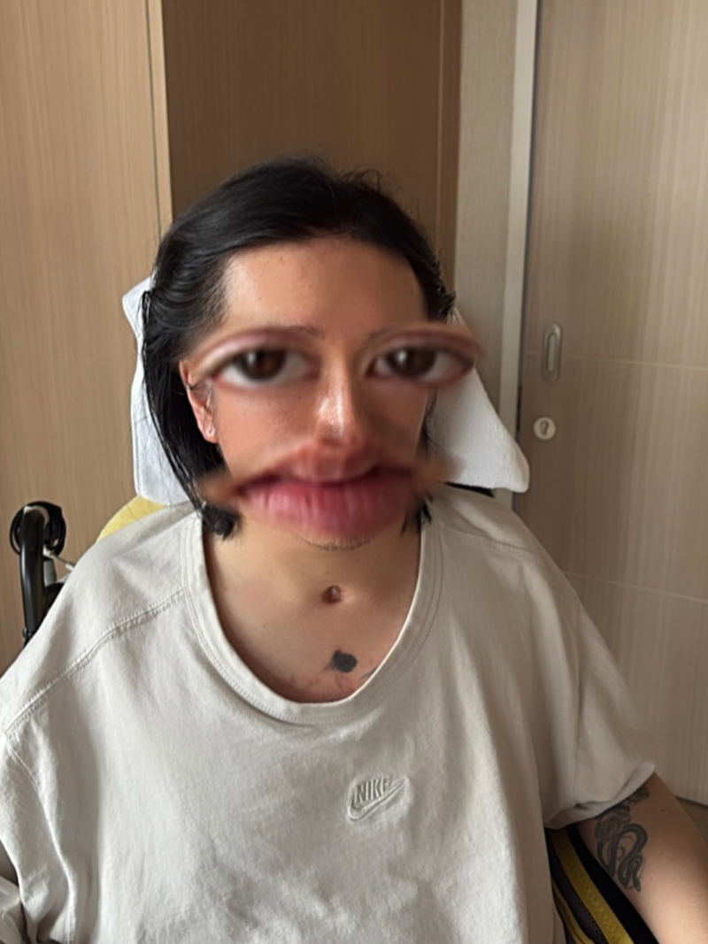 阿Mo李启言今日(23日)晚上首次在受伤后发布近照。 阿Mo李启言今日(23日)晚上首次在受伤后发布近照。