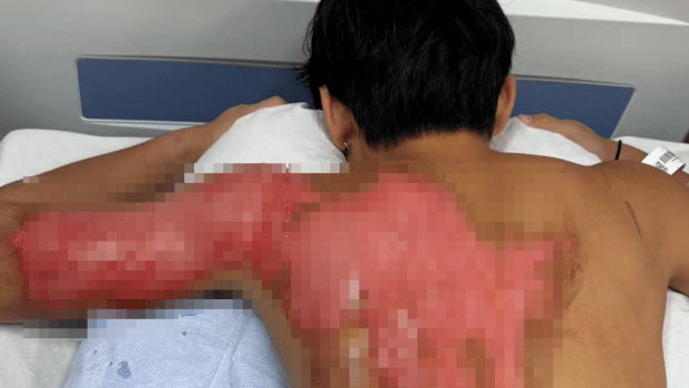 天水围谭仔倒泻热水壶 天水围谭仔倒泻热水壶