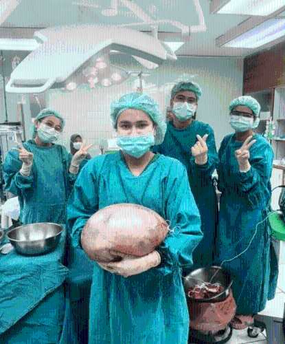 卵巢囊肿1 卵巢囊肿1