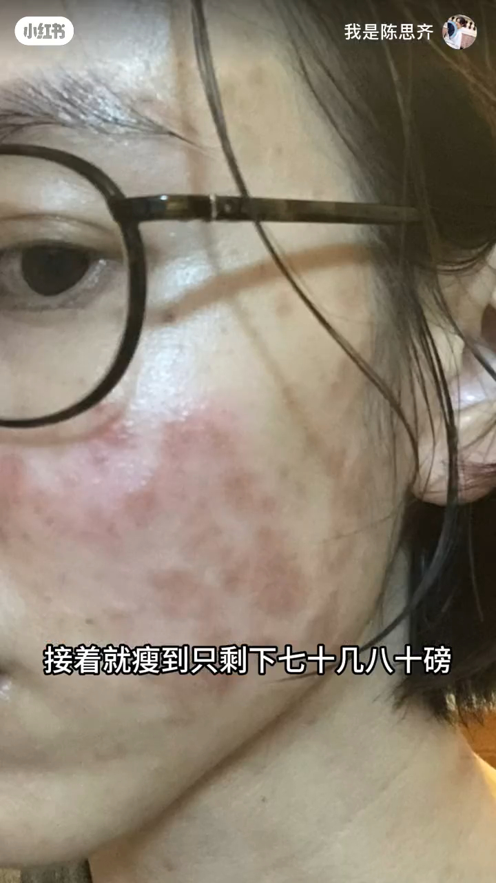 陈思齐俏脸大面积变黑。 陈思齐俏脸大面积变黑。