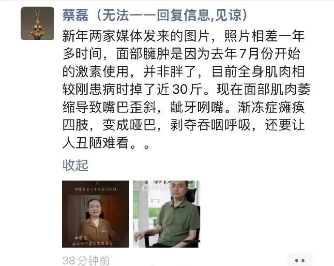 渐冻人2 渐冻人2