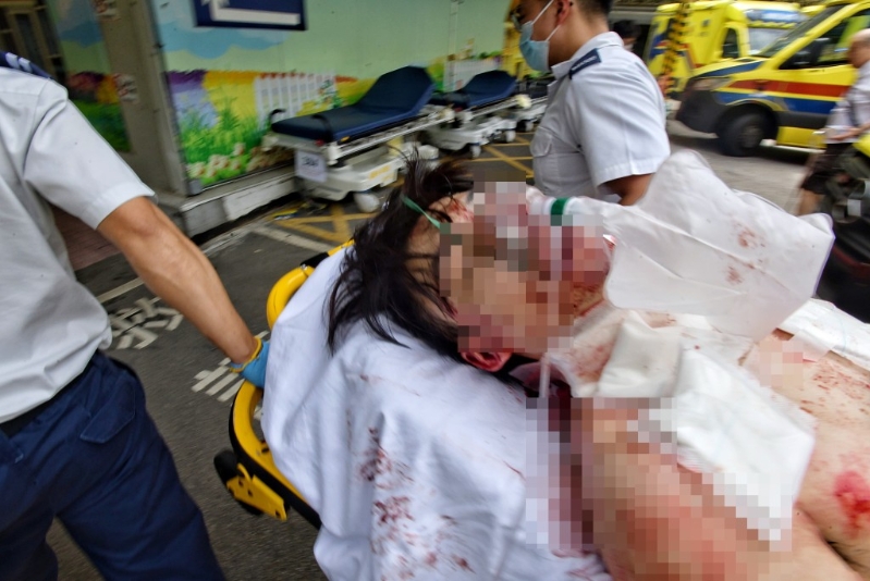 伤者送院抢救。 伤者送院抢救。