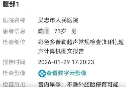 示意图1 示意图1