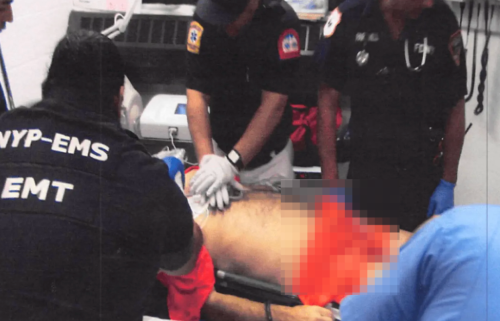 急救人员正在对爱泼斯坦进行心肺复苏 急救人员正在对爱泼斯坦进行心肺复苏