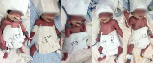 24岁新疆产妇诞5胞胎 24岁新疆产妇诞5胞胎