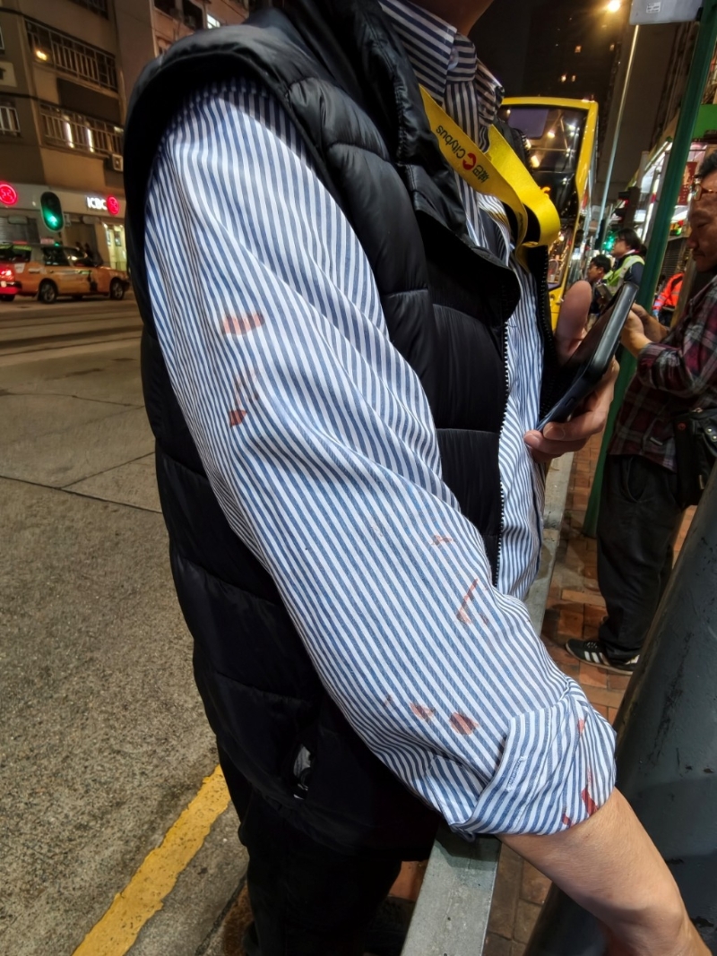 车长制服被疑犯血迹所染。 车长制服被疑犯血迹所染。