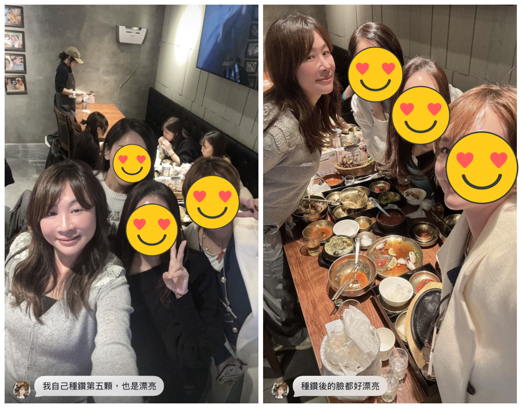 路永佳对医美成果满意表示,“种钻后的脸都好漂亮”。 路永佳对医美成果满意表示,“种钻后的脸都好漂亮”。