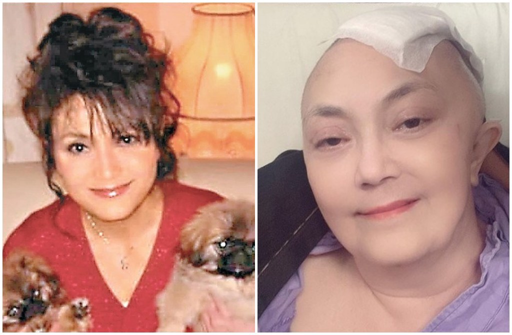 施明2022年跌倒重创头部,紧急住院动开脑手术。 施明2022年跌倒重创头部,紧急住院动开脑手术。