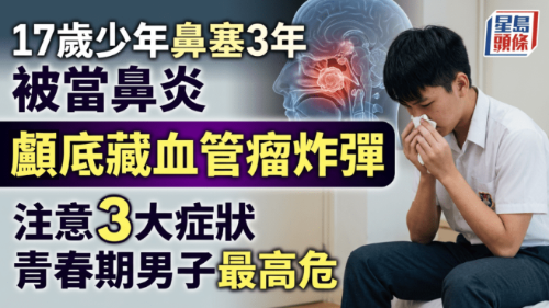 17岁少年鼻塞3年被当鼻炎 17岁少年鼻塞3年被当鼻炎