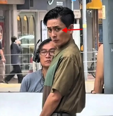 黄宗泽去年于街头被捕获,被指激瘦变成皮包骨。 黄宗泽去年于街头被捕获,被指激瘦变成皮包骨。